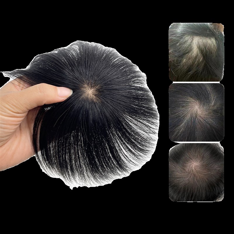 假发片男全真人发头旋发缝男士补发遮盖伤疤头顶部稀少脱发补发片