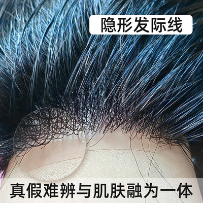 生物头皮假发男短发全真发头顶前额补发光头秃顶超薄隐形男士假发