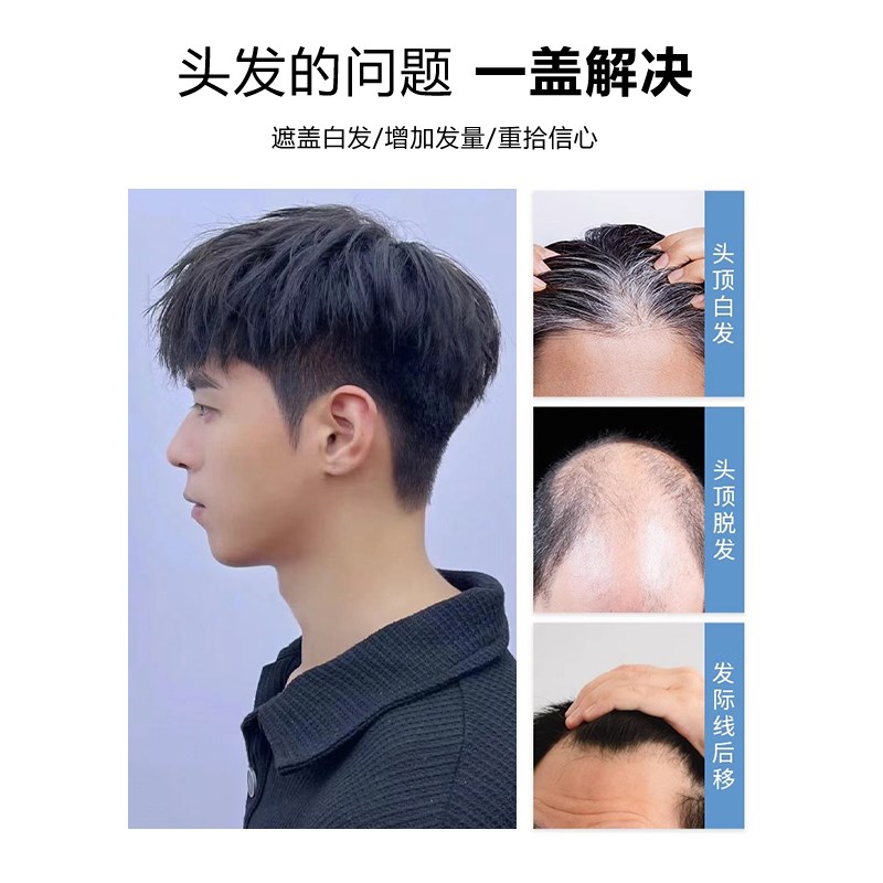假发男短发毛寸全真发无痕隐形假发片男士韩版自然轻薄头顶补发片
