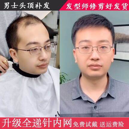 假发男短发韩版帅气轻薄无痕男式秃顶真人发丝补发男士头顶补发片