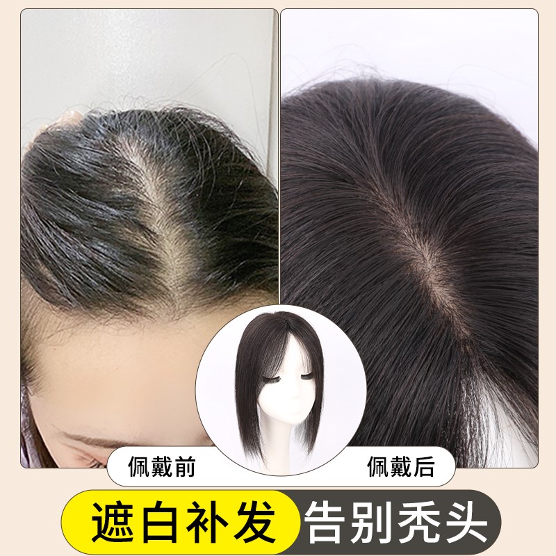 双递针假发女片头顶真发透气夏天薄款遮白发蓬松增发量无痕假发片