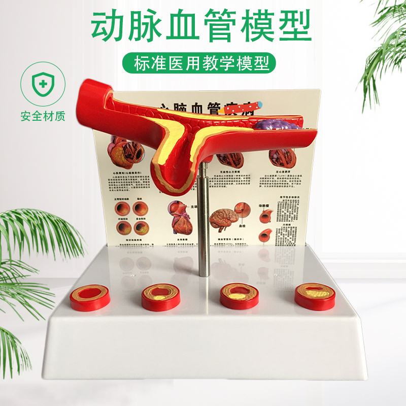 人体支脉粥样11硬化 心血管动脉1解剖模型 血栓 模型人体血管模型