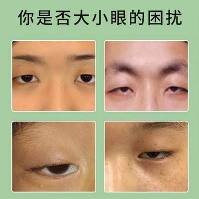 大小眼矫正器上眼皮松弛提拉紧致下垂双眼皮神器眼脸肌无力训练贴