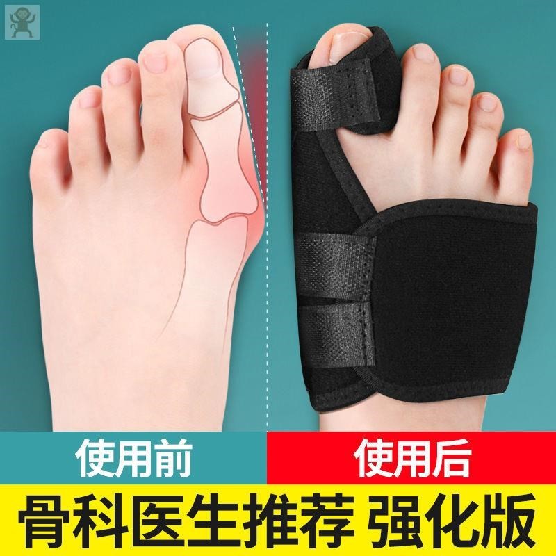 脚趾骨折固定器趾骨折固定支具脚面骨折固定护具大拇指外翻内翻