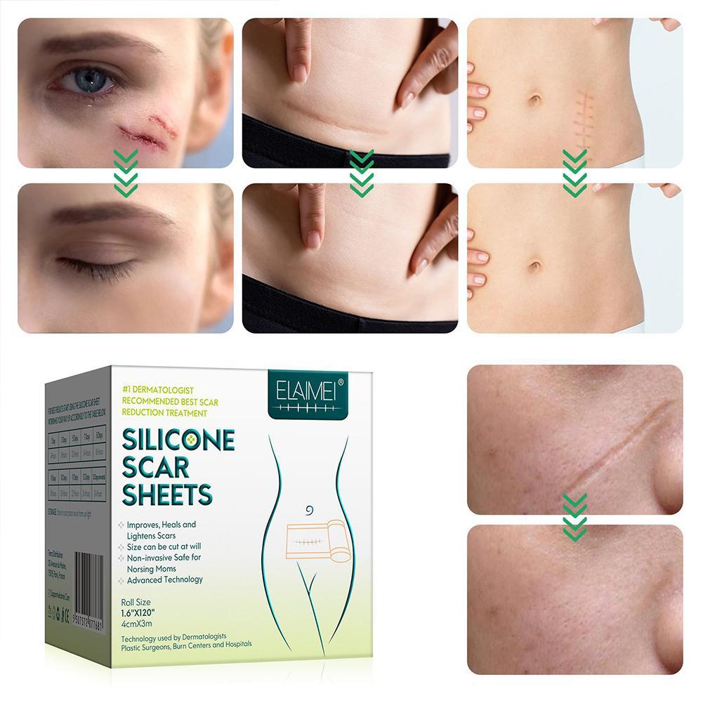 4x300cm Efficient Surgery Scar Removal Silicone Gel Sheet Th