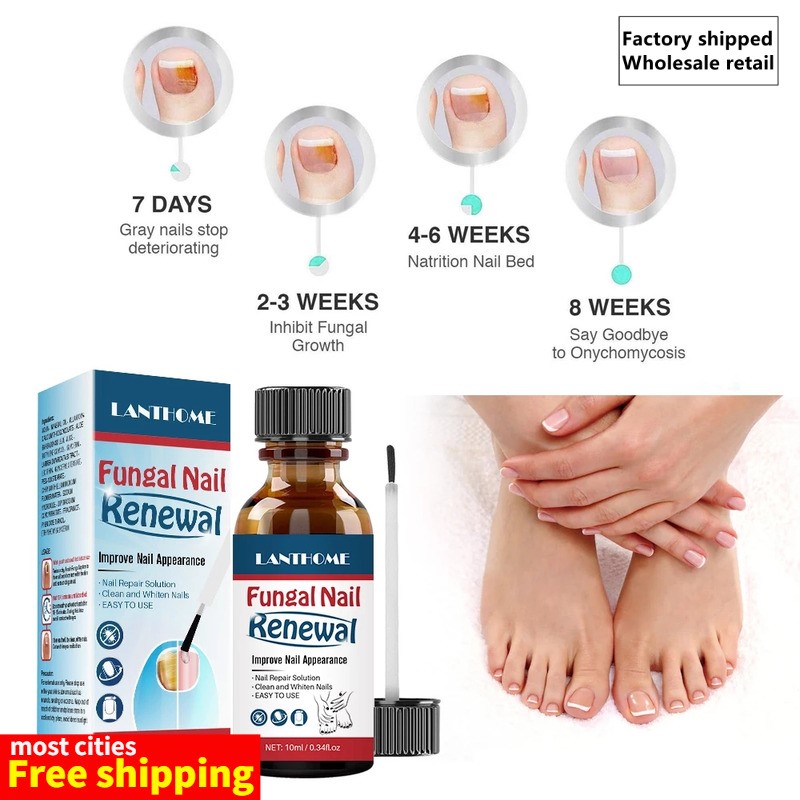 Fungal Nail Renewal Anti Fungus Nails Solution Clean Whiten