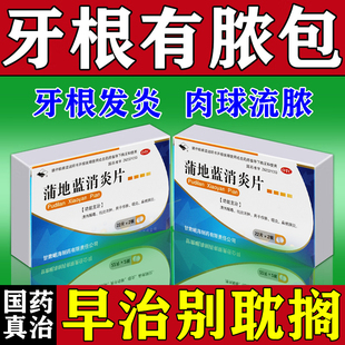 牙龈脓包肿包肿痛发炎起包流脓水消炎药去脓牙根尖炎牙周炎专用