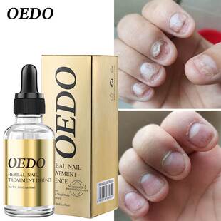 Fungal Nail Treatment Essential Oil Hand and Foot Whitening