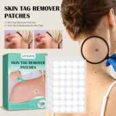 120pcs Pimple Skin Remover 360 Ance Tag Patch Plaster