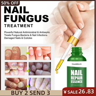Nail Fungus Treatments Repair Serum Feet Care Foot Fungal