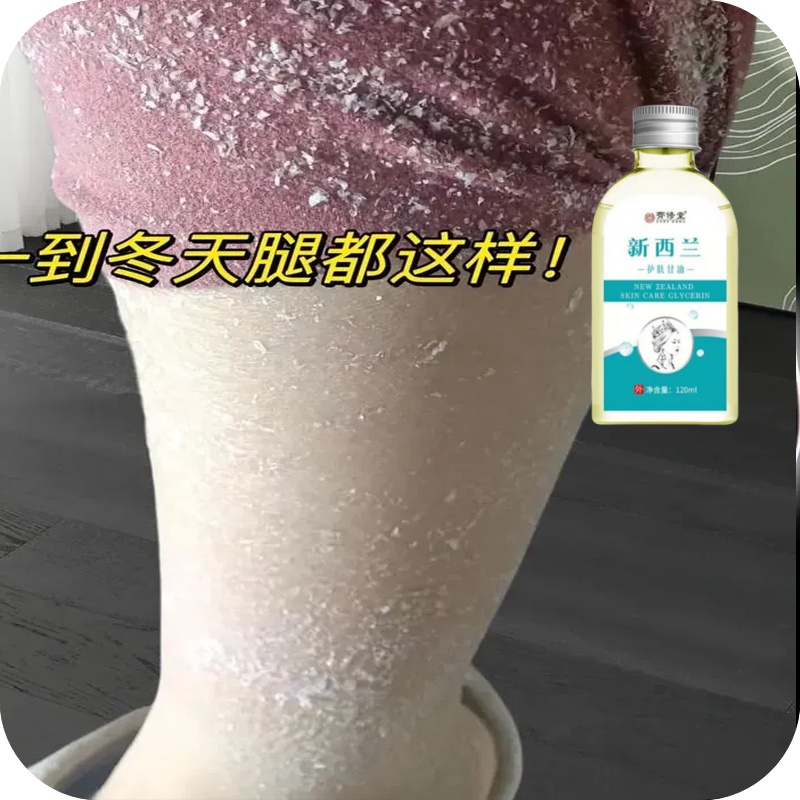 冬天小腿掉皮屑粗糙痒身上干燥起皮皮肤干燥干皮腿部鱼鳞皮肤去除