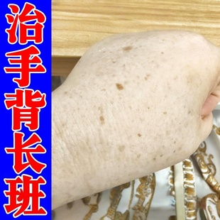 老年班去除手上黑斑面部雀班手背手部晒斑黄褐斑点黑色素淡化软膏