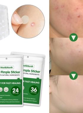 36Pcs Acne Pimple Patch Invisible Waterproof Absorb Pus Acne