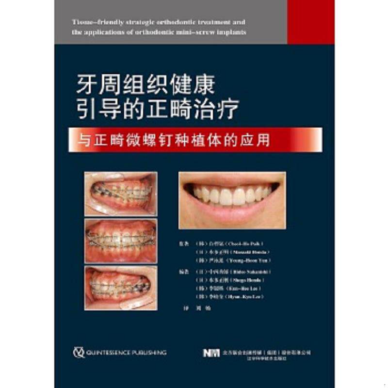 正版速发9787559115911 牙周组织健康引导的正畸治疗于正畸微螺钉种植体的应用 (日)中西秀郎(HideoNakanishi)(日)本多正刚
