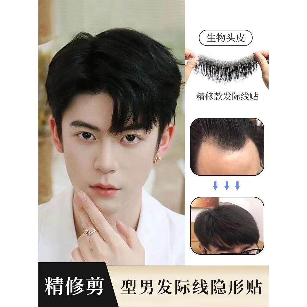 发际线假发贴男士前额假刘海m型发际线贴假发贴男隐形无痕全真发