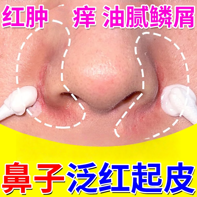 鼻子两侧发红脱皮鼻翼两边泛红干燥起皮油腻掉皮脂溢性皮焱专用膏