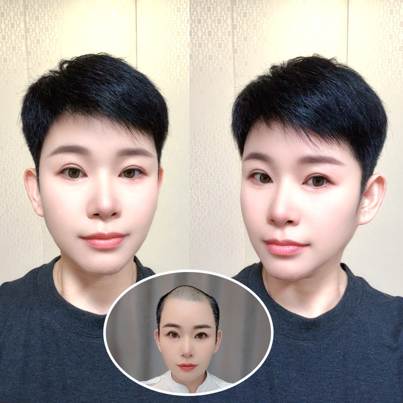 芊亿男士头顶地中海脱发假发片