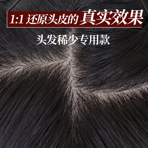 芊亿真人发丝头顶补发片无痕假发