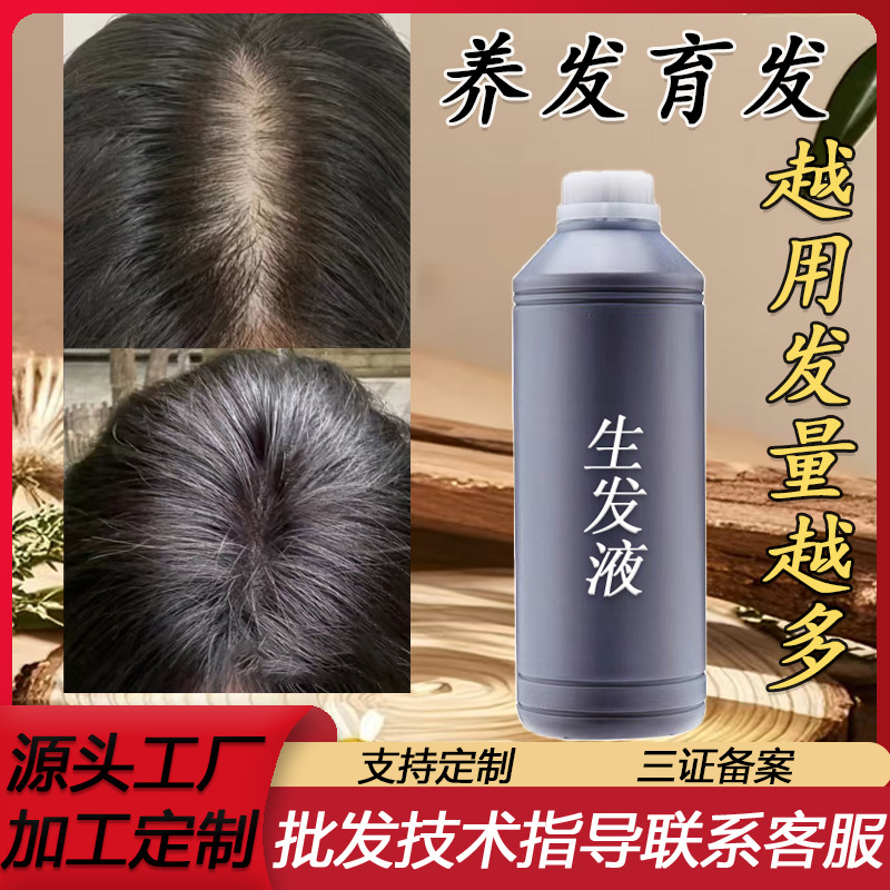 育发液增发液防脱育发液增长发密发修复头皮毛囊何首乌防脱精华液