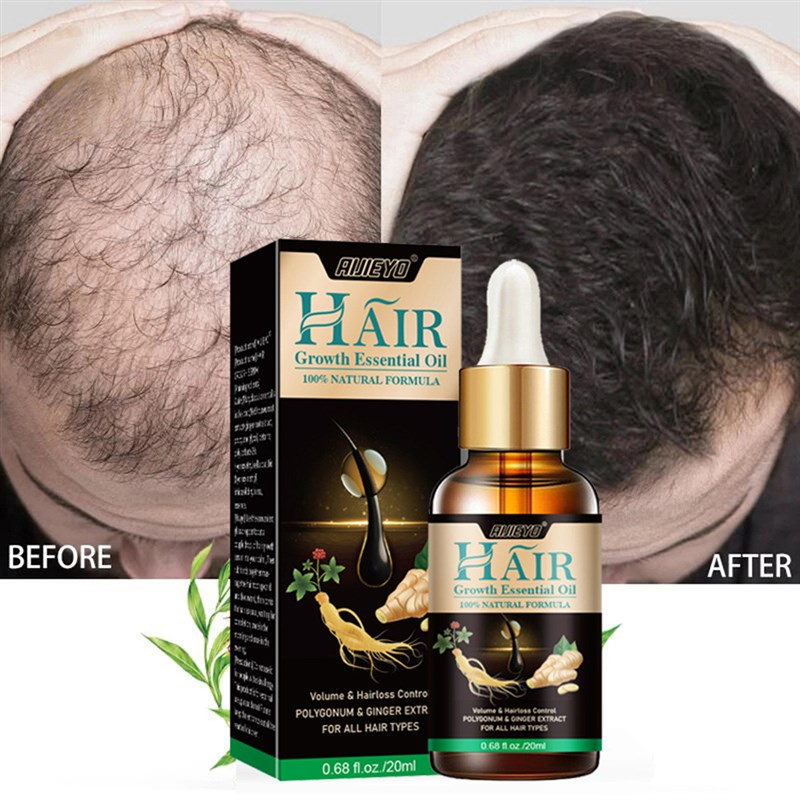 7 Days Ginger Hair Growth Products Natural Anti Hair Loss Pr