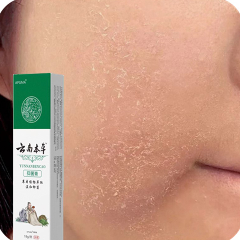 脸上长痒脸上痒面部脸痒下巴起皮干燥脸干掉皮冶脸部过敏脸痒干痒