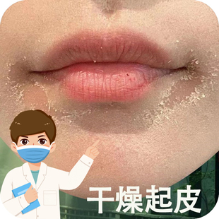 脸上干燥起皮脸干燥干皮脱皮干痒秋冬脸部掉皮发痒皮肤粗糙起干皮