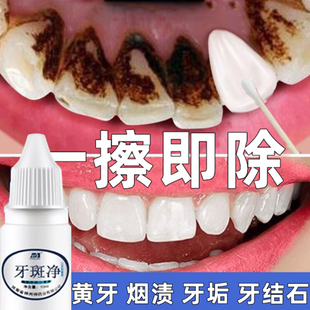 洗牙粉修复去黄牙烟渍亮白洗牙齿污垢清洁神器速效溶解去除牙结石