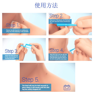 Blue Set Skin Tag Removal Kit Home Use Mole Wart Remover Equ