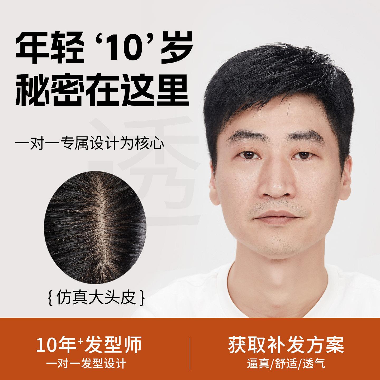 双递针仿真头皮补发片轻薄透气隐形男短发头顶前额假发片全真人发