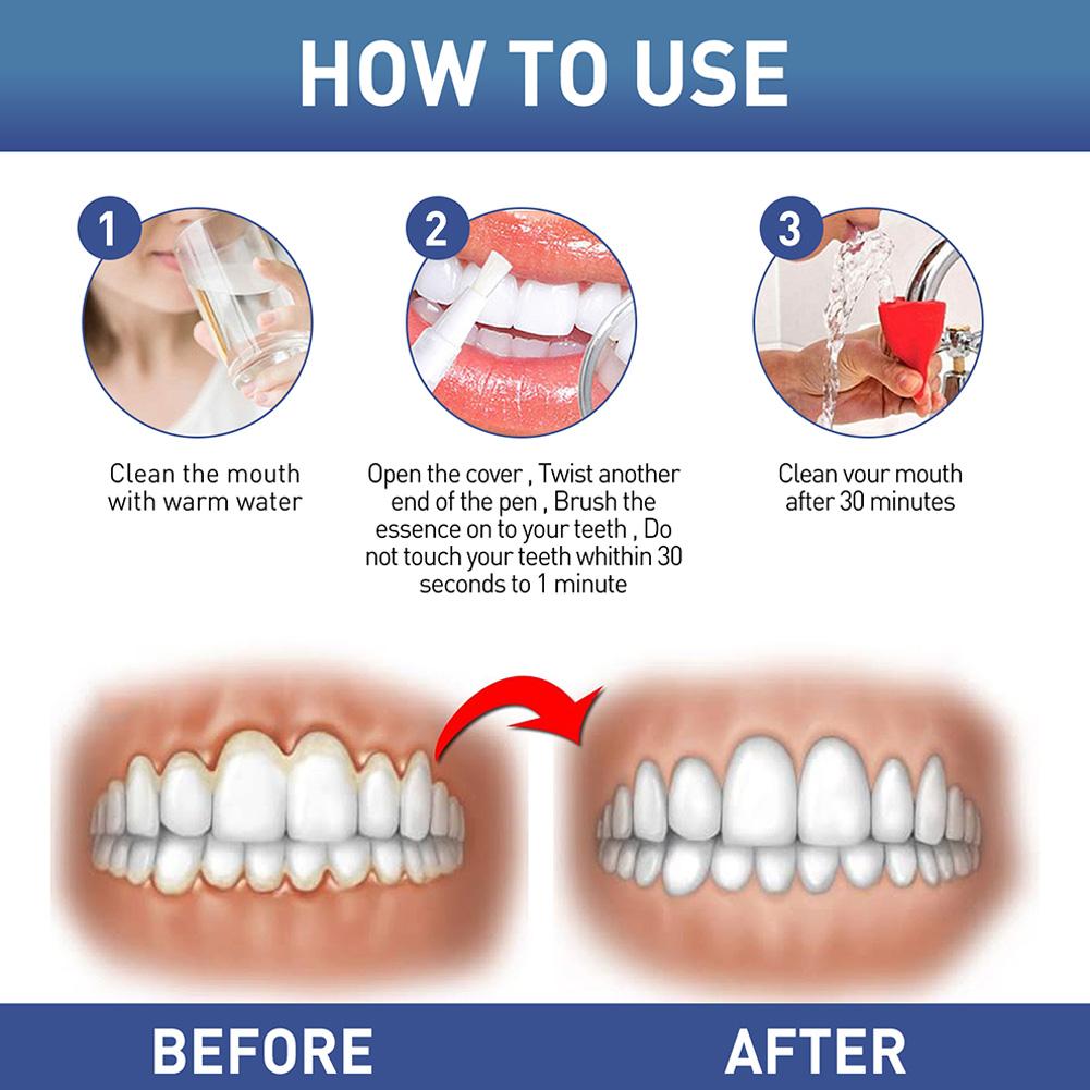 Teeth Whitening Essence Pen Bleaching Teeth Gel Pen Teeth Cl