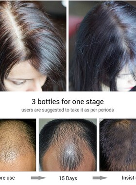好货Hair Growth Oil Hair Loss Thinning Haircare Serum Baldne