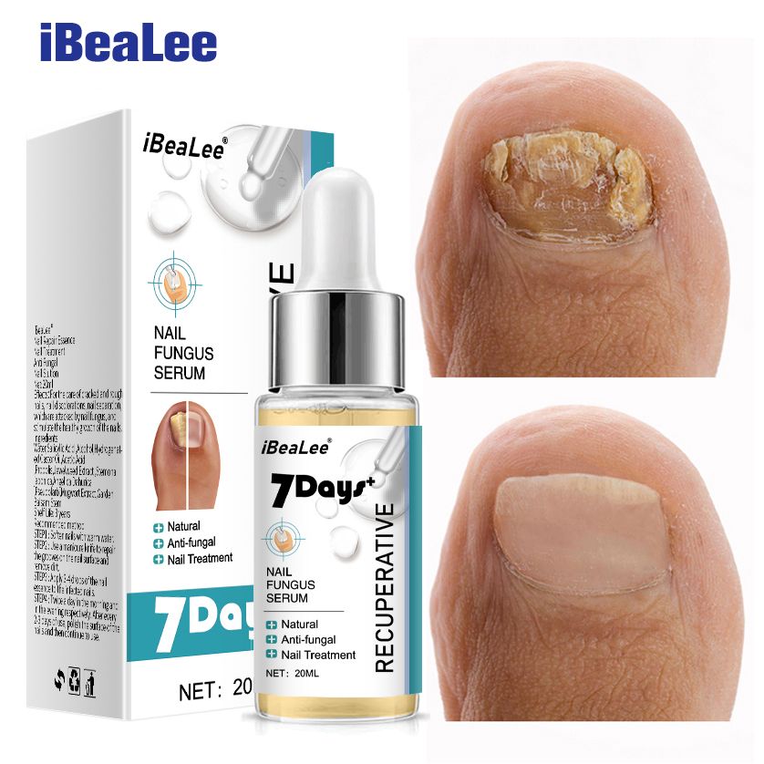 iBeaLee Repair Grey Nail Fungus Treatments Essence Foot Care