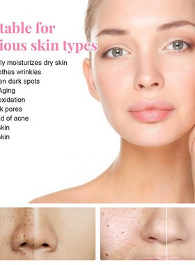 Colgeno complexo soro manchas na pele repara??o essnci