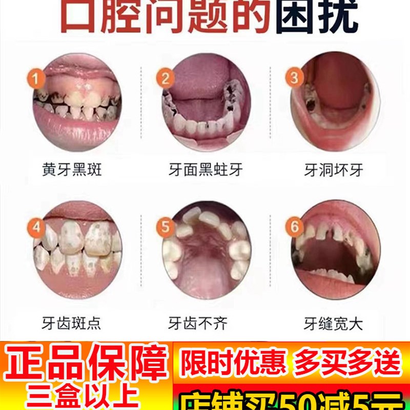 儿童去牙菌斑祛除神器去黑牙黑斑黑渍污垢清洁黄牙膏含氟美白牙齿