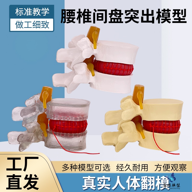 蓝蝶模型腰椎间盘受压演示教具