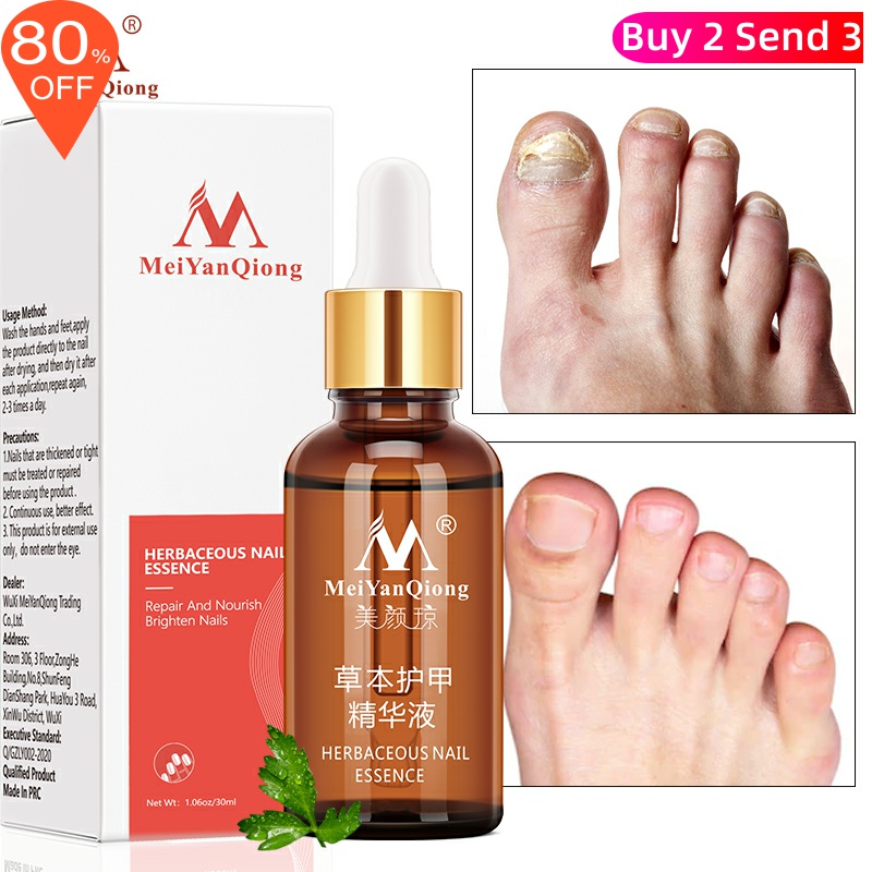 Fungal Nail Treatment Feet Care Essence Nail Foot Whitening