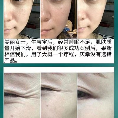极速祛皱纹抬头纹鱼尾纹川字纹法令纹面霜额头贴男女神器提拉紧致