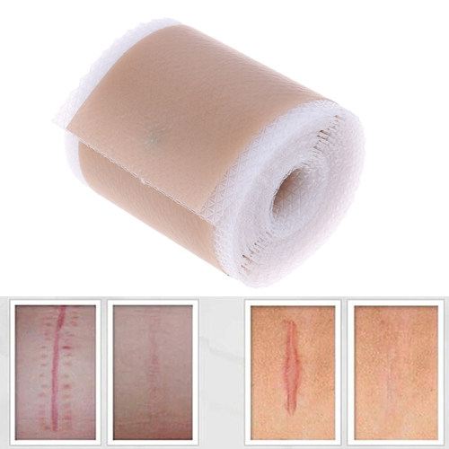 极速4x150cm Efficient Surgery Scar Removal Silicone Gel Shee