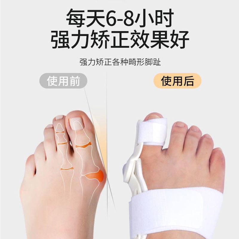 新款直销大脚趾拇指外翻矫正器日夜可穿男女通用重叠趾脚骨外翻脚