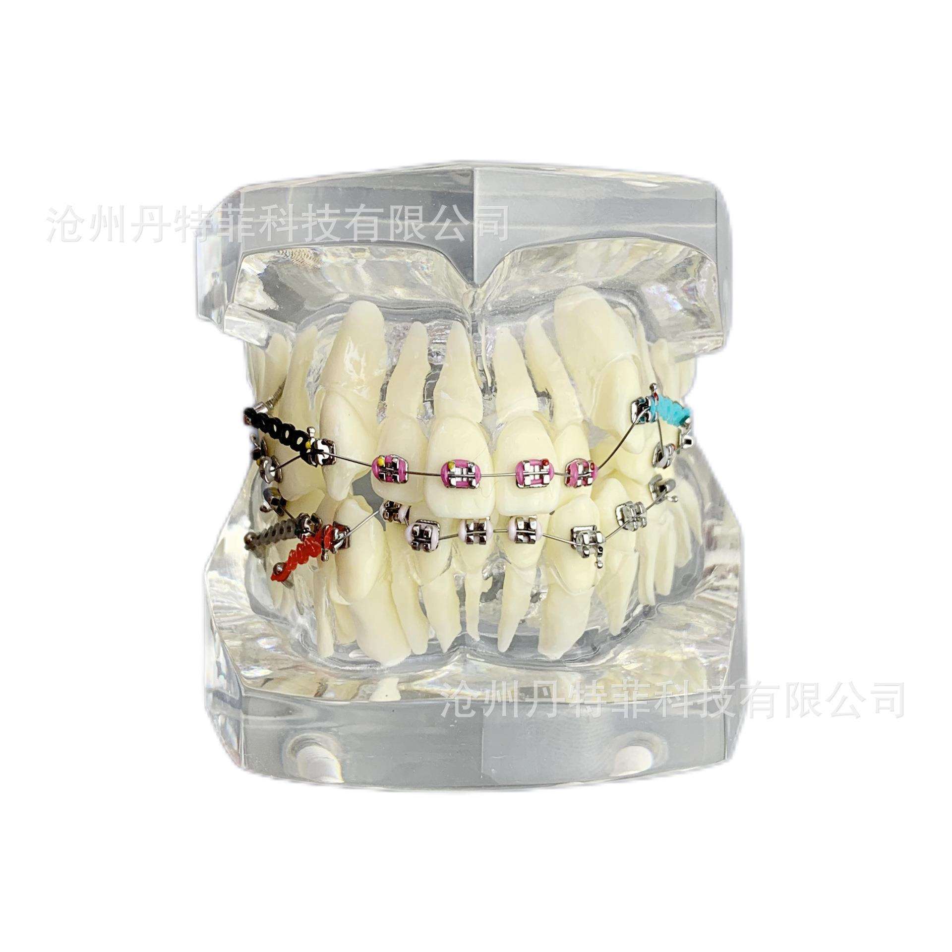 M3005-3矫正牙齿模型透明色正畸模型牙齿矫正模型