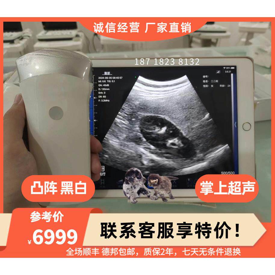 Sonostar掌上超声 手持超声 无线探头 彩超机b超机 肌骨 宠物兽用