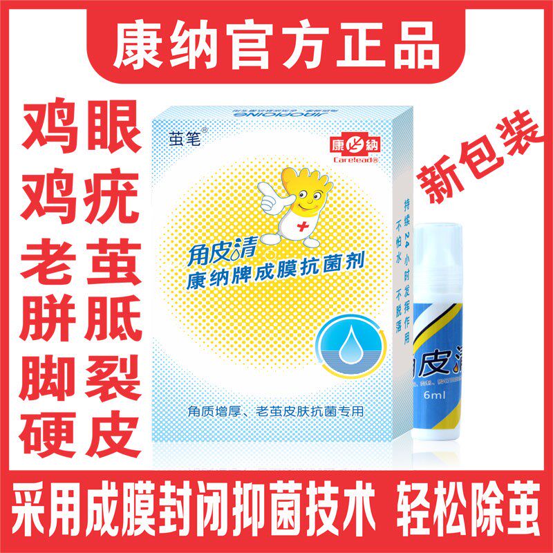 热销康纳角皮清老茧疣瘊子刺脚底根脚茧手茧死皮去除鸡眼茧子角质