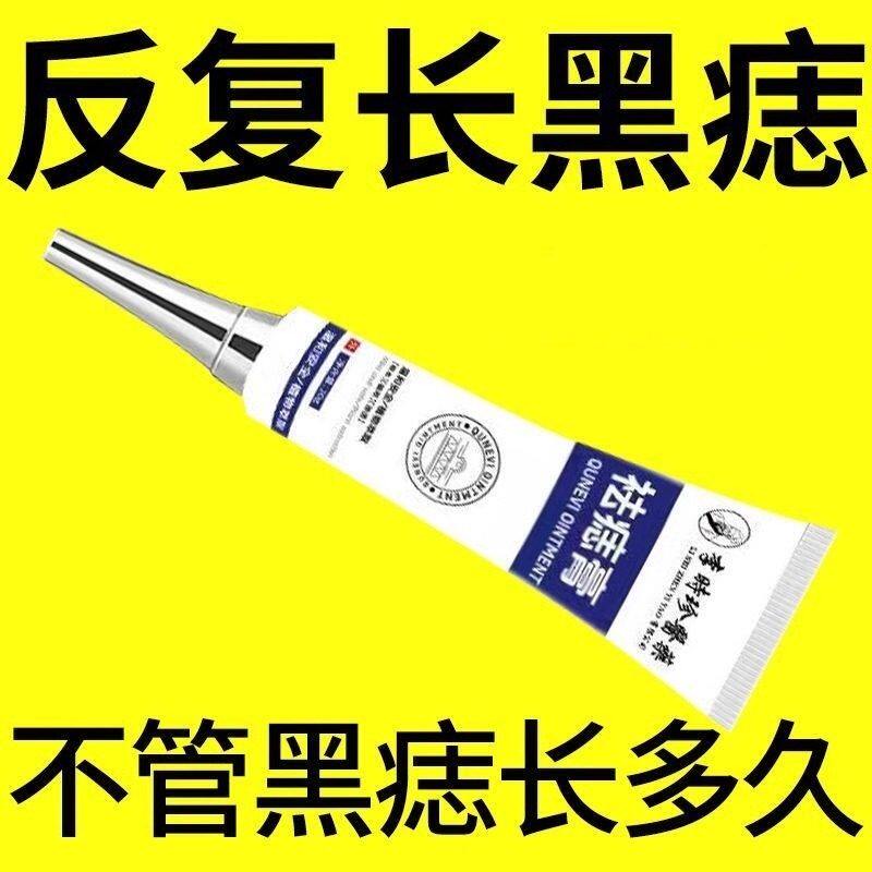哪有黑点抹哪里温和黑斑雀斑黑痣痦子祛痣膏