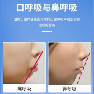 X型呼吸贴闭嘴贴 口呼吸贴矫正闭口贴防止睡觉张口张嘴呼吸止鼾贴