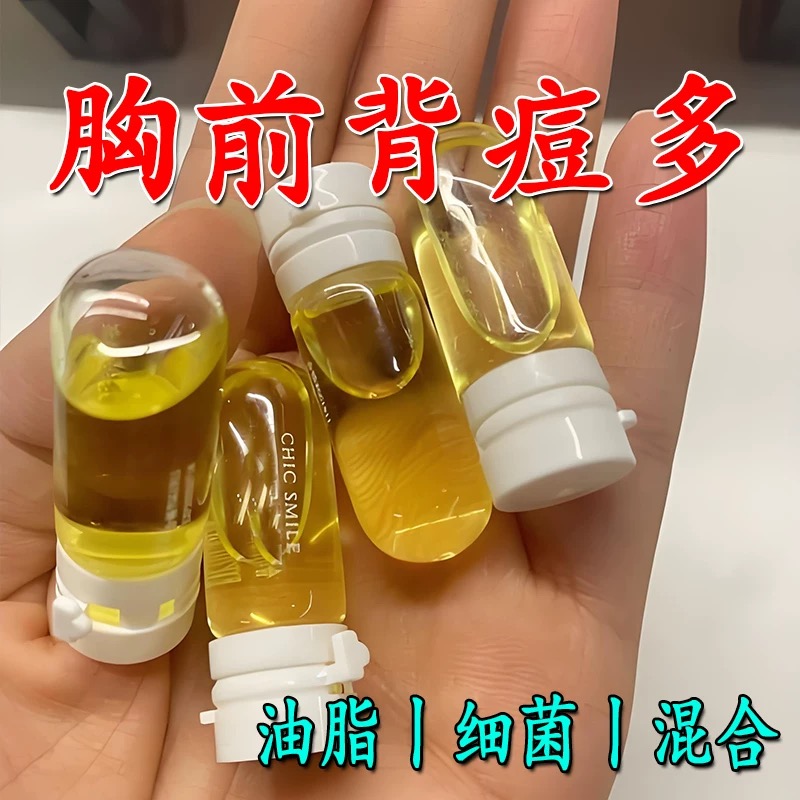 【正品保障】背痘喷雾祛痘印去前胸脖子背部粉刺除螨背上长痘美背