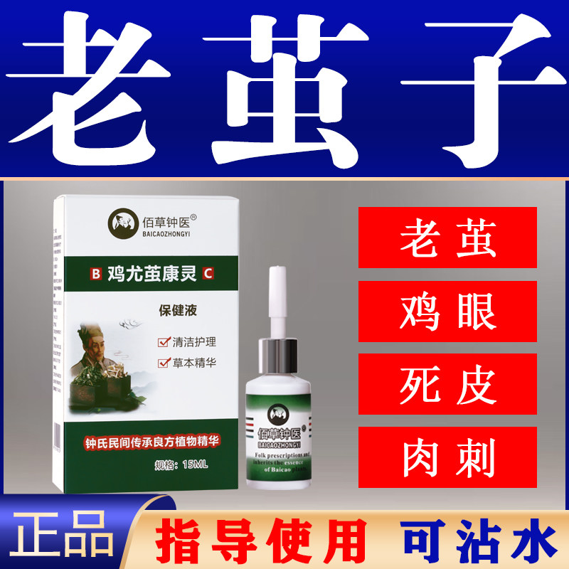鸡眼老茧脚底茧子死皮软化剂