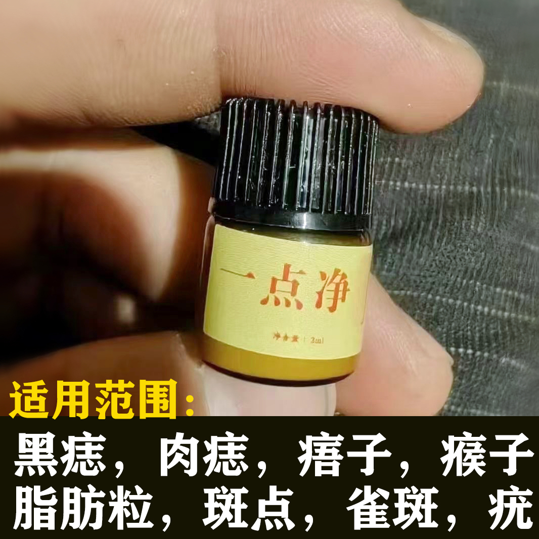 点痣膏无痕正品脸部点痦子点痣药水神器仪去除黑点取痣去黑痣专用