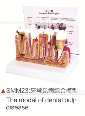 SMM23牙常见病组合模型
