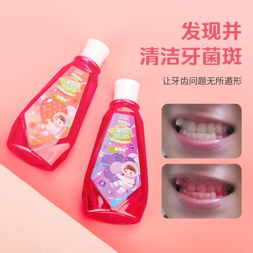 儿童成人牙菌斑显色漱口水清洁口腔检测仪显色剂显示液牙菌斑祛除