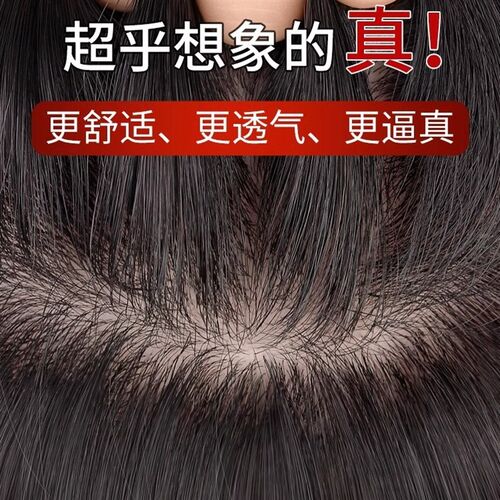 诺菲蓬松头顶增发量假发片女头顶真发全真人发遮白发补发发片浏海